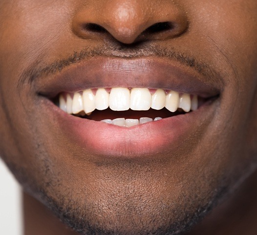 Man with healthy smile after metal free dental crown placement