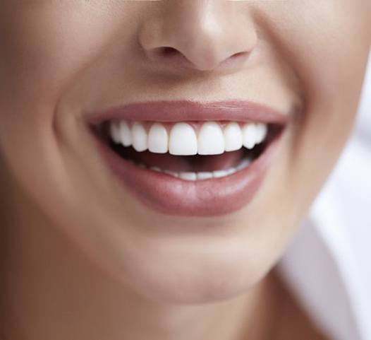 close up of a person smiling with perfectly straight, white teeth 